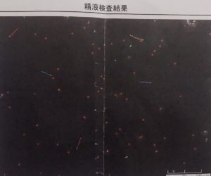 男性の不妊治療 精子検査で知った精子濃度や精子運動率について