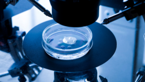 ショート法?ロング法?アンタゴニスト法?何を選べばいいのだろう?